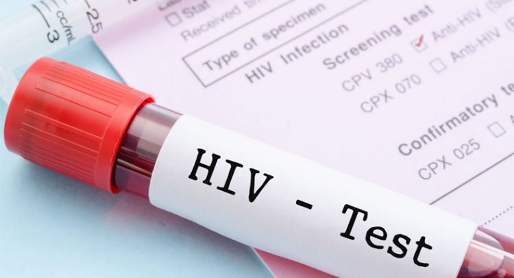 5,700 People Are Living With HIV In Upper West – GAC