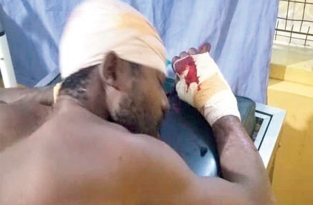 Man Butchered Over Plantain