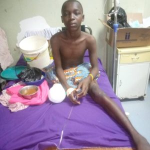 Boy Needs Artificial Limbs To Continue School