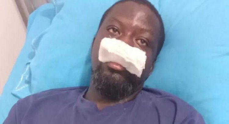 Artist Ibrahim Mahama Hospitalized After Alleged Police Assault in Tamale